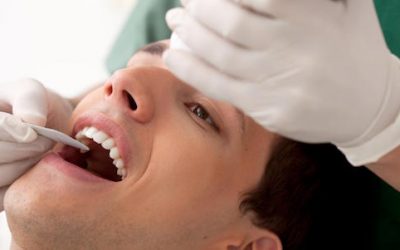 7 Reasons Why You Should Undergo Teeth Whitening