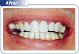 cosmetic dentistry