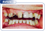 cosmetic dentistry bondi beach