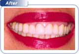 Cosmetic dentistry