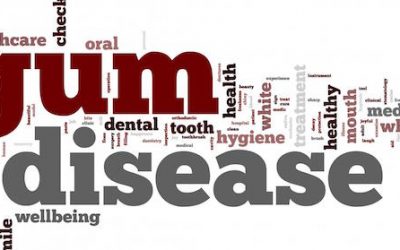 How To Beat Gum Disease