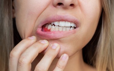 6 Foods That Fight Periodontitis