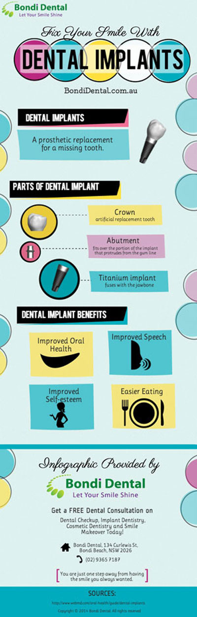 Fix Your Smile With Dental Implants
