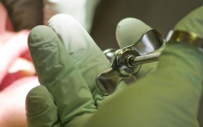 Root Canal Treatment And Dental Pulp Infection