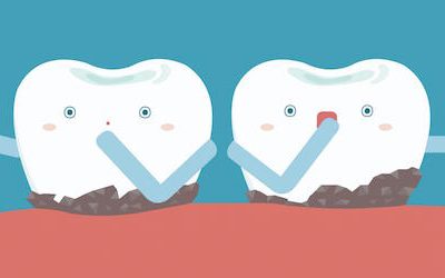 Dental Erosion, Its Causes, And Preventive Tips