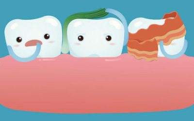Dentist Bondi: How Eating Habits Impact The Freshness Of Your Breath