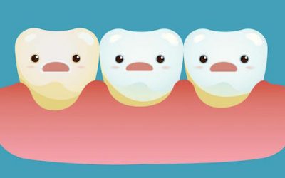 How Acids Harm Your Teeth