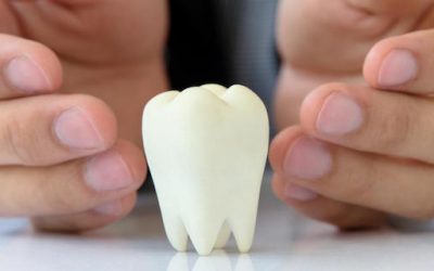 What Are Third Molars?