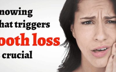 Bondi Dentist Advice: Top 9 Risk Factors for Tooth Loss