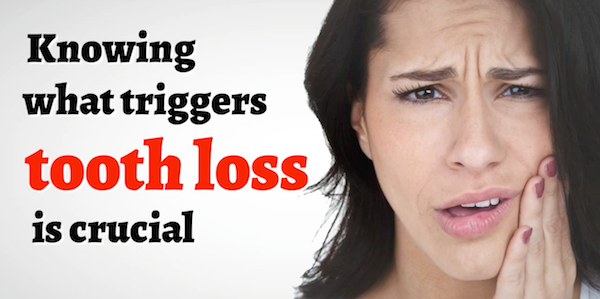 Top 9 Risk Factors for Tooth Loss | Bondi Dental