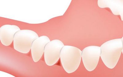 Denture Care in Bondi: Best Rules to Follow for Dentures