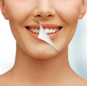 Teeth Whitening Home Remedies