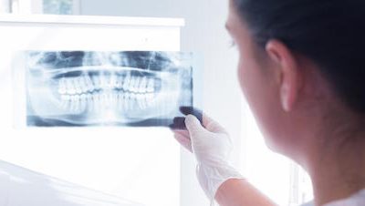The Right Time to Get Dental X-rays