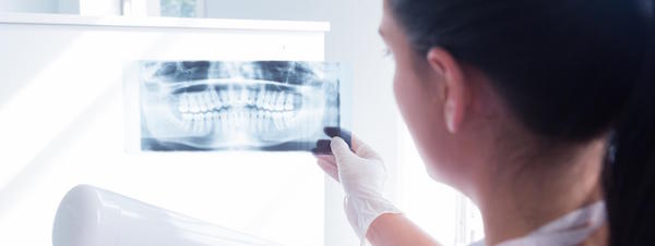 The Right Time to Get Dental X-rays