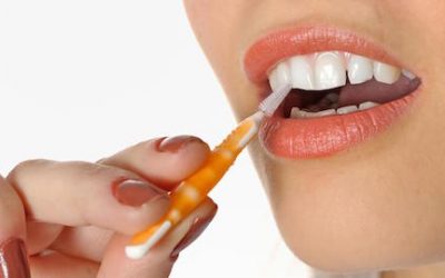 Interdental Brush: What and How to Use?