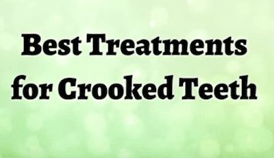 Best Treatments for Crooked Teeth