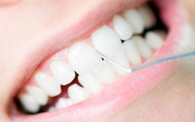 Professional Teeth Cleaning in Bondi: What are the Top 8 Benefits?