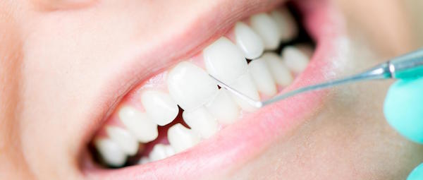 Professional Teeth Cleaning in Bondi: What are the Top 8 Benefits?