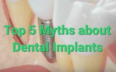 Top 5 Myths about Dental Implants