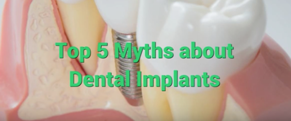 Top 5 Myths about Dental Implants