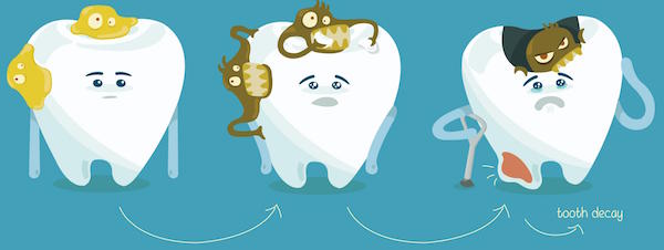 Tooth Decay and Sports drinks | Bondi Dental