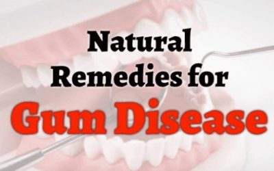 Natural Remedies for Gum Disease
