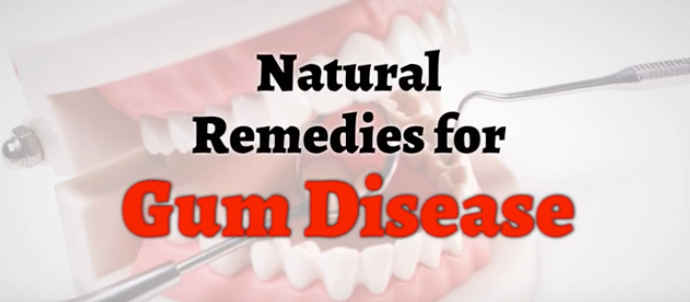 Natural Remedies for Gum Disease