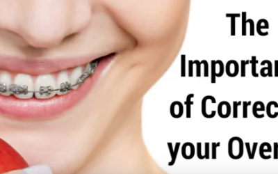 The Importance of Correcting your Overbite