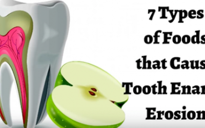 7 Types of Foods that Cause Tooth Enamel Erosion