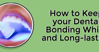 How to Keep your Dental Bonding White and Long-lasting