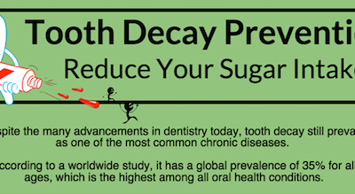 Tooth Decay Prevention: Reduce Your Sugar Intake