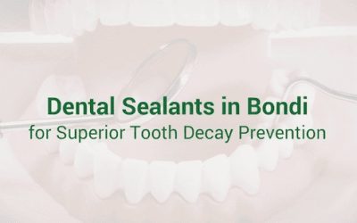 Dental Sealants in Bondi for Superior Tooth Decay Prevention