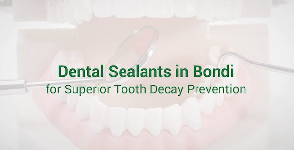 Dental Sealants in Bondi for Superior Tooth Decay Prevention