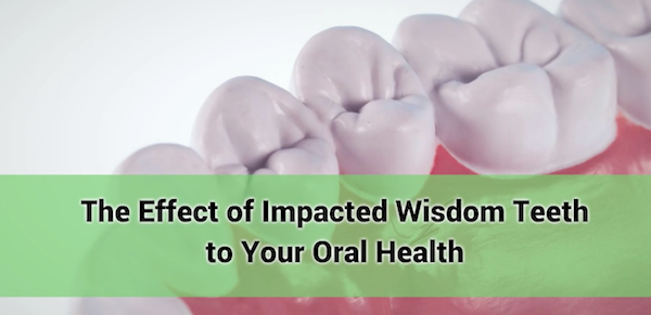 The Effect of Impacted Wisdom Teeth to Your Oral Health