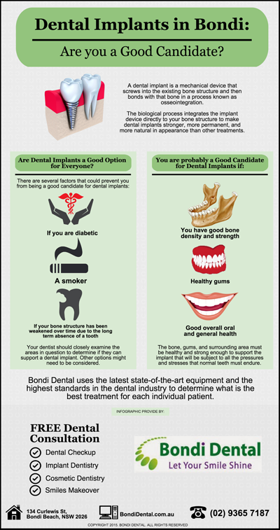 Dental Implants in Bondi: Are you a Good Candidate?