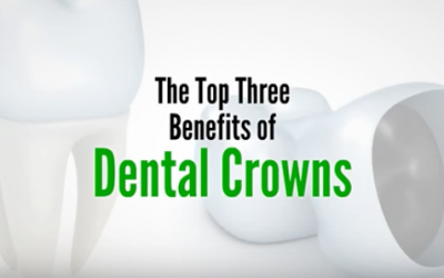 The Top Three Benefits of Dental Crowns