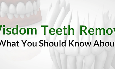 Wisdom Teeth Removal: What You Should Know About It