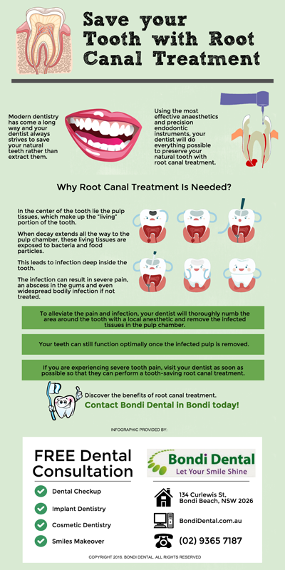 Save-your-Tooth-with-Root-Canal-Treatment