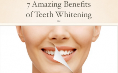 7 Amazing Benefits of Teeth Whitening