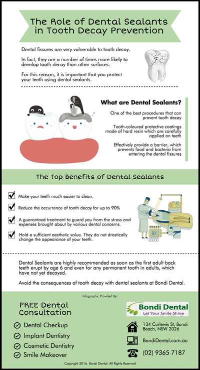 The-Role-of-Dental-Sealants-in-Tooth-Decay-Prevention