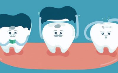 Your Simple Guide to Dental Crowns