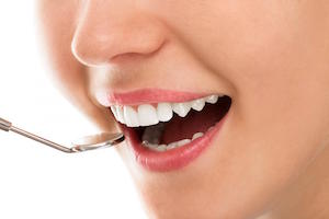 Improve Your Smile With White Fillings in Bondi bondi dentist