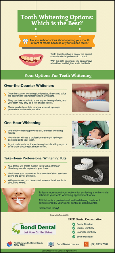 Tooth Whitening Options: Which is the Best?