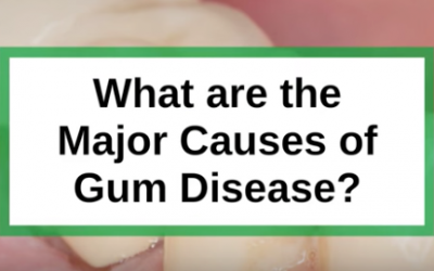 What are the Major Causes of Gum Disease?