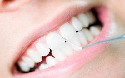 Professional Teeth Cleaning Improves Oral Health