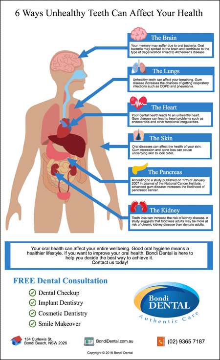 Bondi-Dentist-Trivia-6-Ways-Unhealthy-Teeth-Can-Affect-Your-Health