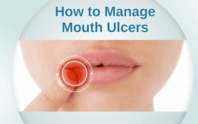How to Manage Mouth Ulcers