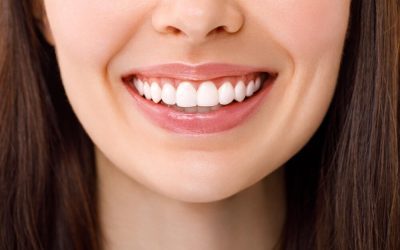 Porcelain Veneers in Bondi: Transform Your Smile with a Natural Look