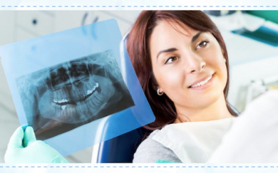 Modern Dental X-rays Made Easy: How Does It Work?