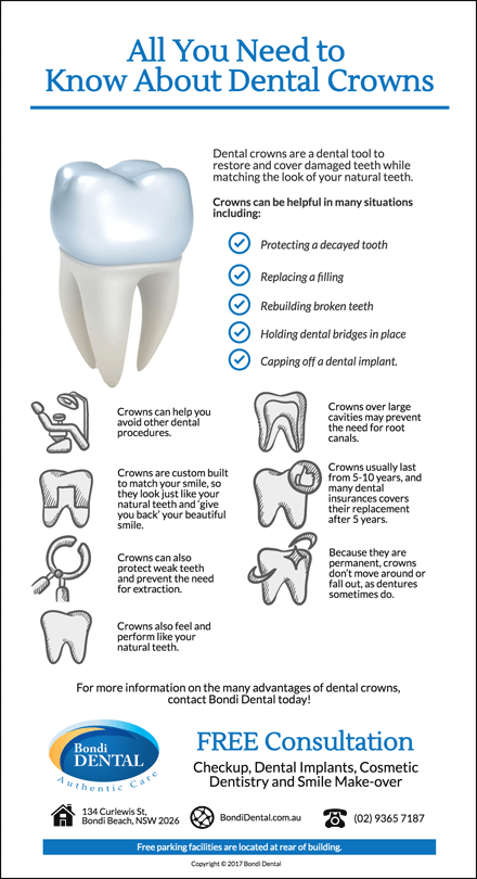 Dental Crowns: Everything You Need to Know